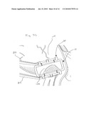 APPARATUS AND METHODS FOR DEPLOYING A CLIP TO OCCLUDE AN ANATOMICAL STRUCTURE diagram and image