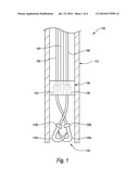 VESSEL CLOSURE DEVICES AND METHODS diagram and image