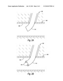 VESSEL CLOSURE DEVICES AND METHODS diagram and image