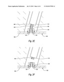 VESSEL CLOSURE DEVICES AND METHODS diagram and image