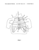 METHOD AND APPARATUS FOR BONE FRACTURE FIXATION diagram and image