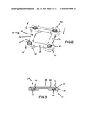 METHOD AND APPARATUS FOR BONE FRACTURE FIXATION diagram and image