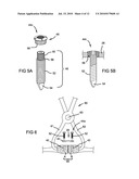 METHOD AND APPARATUS FOR BONE FRACTURE FIXATION diagram and image