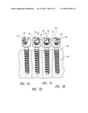 PEDICLE SCREW SYSTEMS AND METHODS OF ASSEMBLING/INSTALLING THE SAME diagram and image