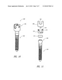 PEDICLE SCREW SYSTEMS AND METHODS OF ASSEMBLING/INSTALLING THE SAME diagram and image