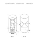 DEVICE AND METHOD FOR TREATING ISCHEMIC HEART DISEASE diagram and image