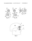 SIDE POSITIONED VISION ENHANCEMENT DEVICE MOUNT diagram and image