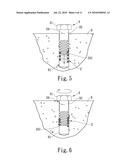  Reusable Expansion Anchoring Assembly and Setting Method Thereof diagram and image