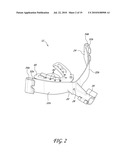 SECUREMENT SYSTEM FOR AN ENDOTRACHEAL TUBE diagram and image