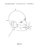 SECUREMENT SYSTEM FOR AN ENDOTRACHEAL TUBE diagram and image