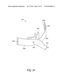SECUREMENT SYSTEM FOR AN ENDOTRACHEAL TUBE diagram and image