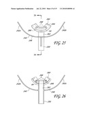 SECUREMENT SYSTEM FOR AN ENDOTRACHEAL TUBE diagram and image