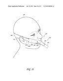 SECUREMENT SYSTEM FOR AN ENDOTRACHEAL TUBE diagram and image