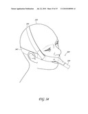 SECUREMENT SYSTEM FOR AN ENDOTRACHEAL TUBE diagram and image