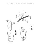 Radiation Arrangement diagram and image