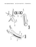 Radiation Arrangement diagram and image