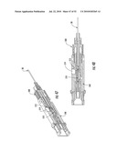 TERMINATION SYSTEM FOR FIBER OPTIC CONNECTION diagram and image