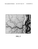 Topical Poloxamer Formulations for Enhancing Microvascular Flow: Compositions and Uses Thereof diagram and image