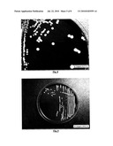 BIFIDOBACTERIUM LONGUM diagram and image