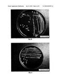 BIFIDOBACTERIUM LONGUM diagram and image