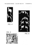 Surgical Applications for BMP Binding Protein diagram and image