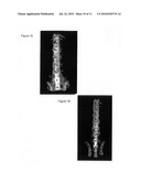 Surgical Applications for BMP Binding Protein diagram and image