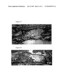 Surgical Applications for BMP Binding Protein diagram and image