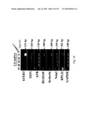 hTERT GENE EXPRESSION REGULATORY GENE diagram and image