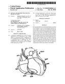 DEVICES AND METHODS FOR ASSISTING HEART FUNCTION diagram and image
