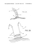 DEVICES AND METHODS FOR ASSISTING HEART FUNCTION diagram and image