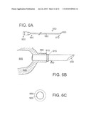 DEVICES AND METHODS FOR ASSISTING HEART FUNCTION diagram and image