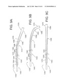 DEVICES AND METHODS FOR ASSISTING HEART FUNCTION diagram and image