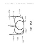 DEVICES AND METHODS FOR ASSISTING HEART FUNCTION diagram and image