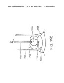 DEVICES AND METHODS FOR ASSISTING HEART FUNCTION diagram and image