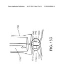 DEVICES AND METHODS FOR ASSISTING HEART FUNCTION diagram and image