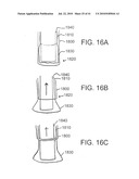 DEVICES AND METHODS FOR ASSISTING HEART FUNCTION diagram and image