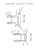 DEVICES AND METHODS FOR ASSISTING HEART FUNCTION diagram and image