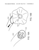 DEVICES AND METHODS FOR ASSISTING HEART FUNCTION diagram and image