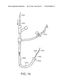 DEVICES AND METHODS FOR ASSISTING HEART FUNCTION diagram and image