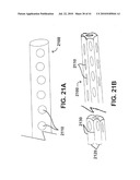 DEVICES AND METHODS FOR ASSISTING HEART FUNCTION diagram and image