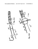 DEVICES AND METHODS FOR ASSISTING HEART FUNCTION diagram and image