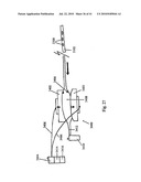 DEVICES AND METHODS FOR ASSISTING HEART FUNCTION diagram and image