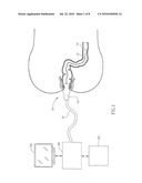 SYSTEM FOR ADVANCING IN A BODY LUMEN diagram and image