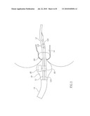 SYSTEM FOR ADVANCING IN A BODY LUMEN diagram and image