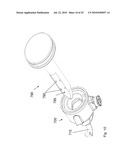 Low-Profile Surgical Access Devices with Anchoring diagram and image