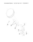 Low-Profile Surgical Access Devices with Anchoring diagram and image