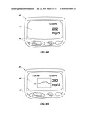 SYSTEM AND METHODS FOR PROCESSING ANALYTE SENSOR DATA diagram and image