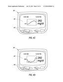 SYSTEM AND METHODS FOR PROCESSING ANALYTE SENSOR DATA diagram and image