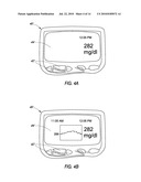 SYSTEM AND METHODS FOR PROCESSING ANALYTE SENSOR DATA diagram and image