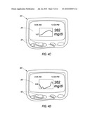 SYSTEM AND METHODS FOR PROCESSING ANALYTE SENSOR DATA diagram and image